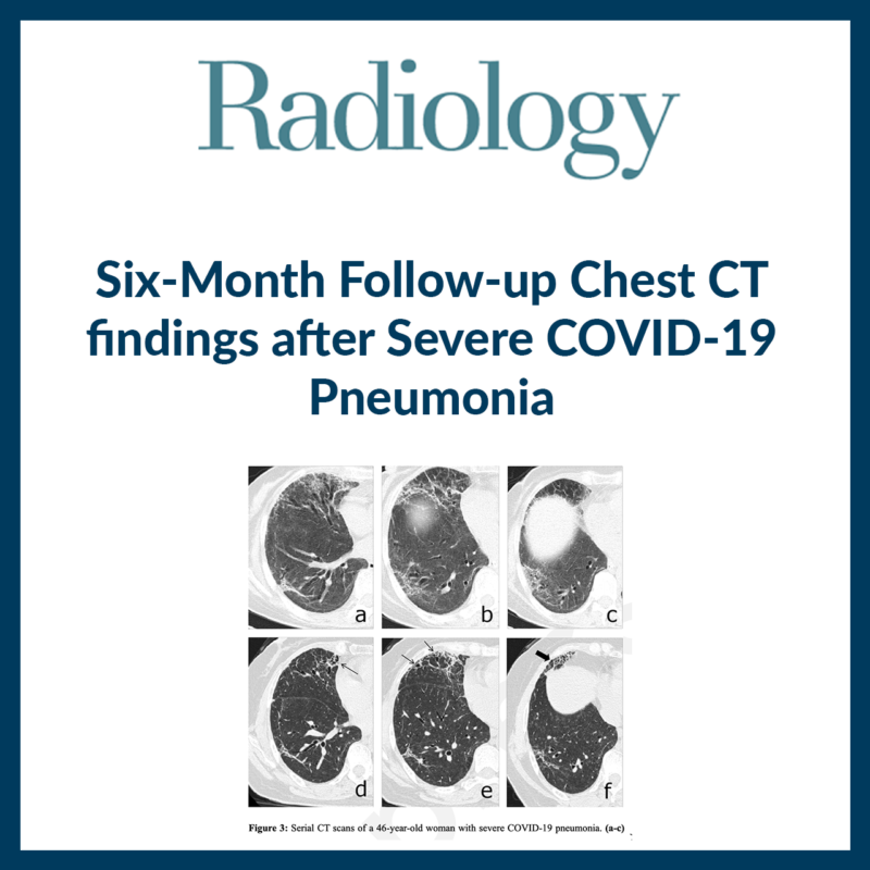 covid 19 pneumonia case study